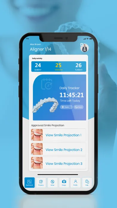Aligner Tracker App应用截图