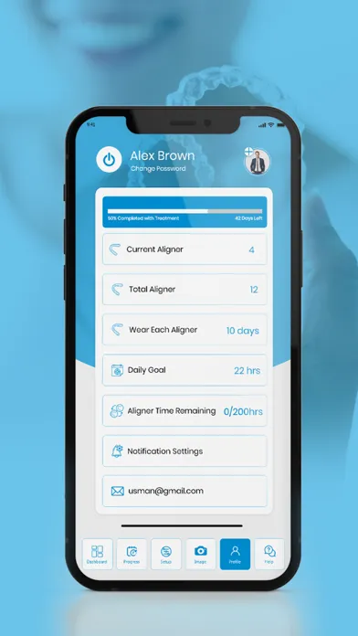Aligner Tracker App应用截图