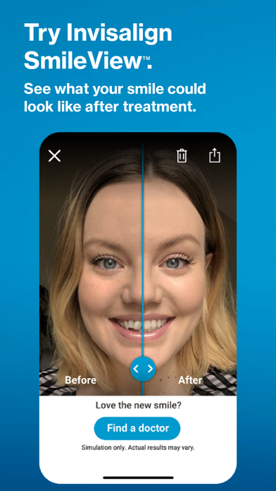 Tangkapan skrin My Invisalign