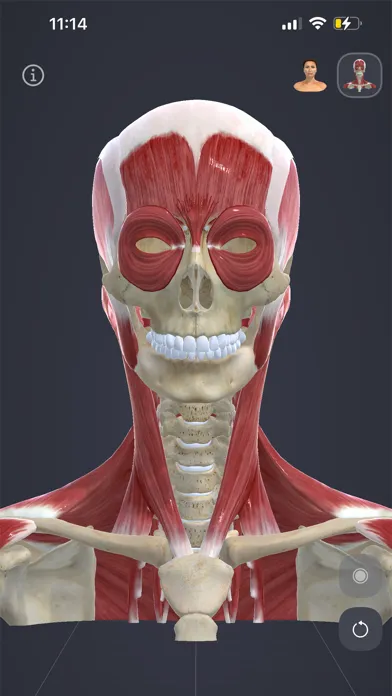 Chronic Migraine Anatomy应用截图