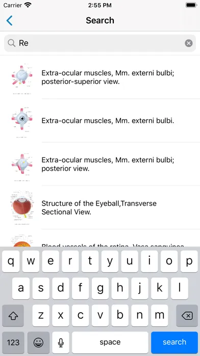 Zrzuty ekranu Ocular Anatomy Atlas