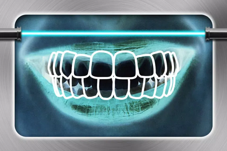 Screenshot di Cavity Detector- Scary Prank Free