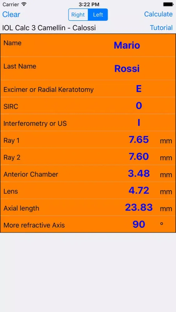 Zrzuty ekranu IOL Calculator 3.0 Camellin Calossi