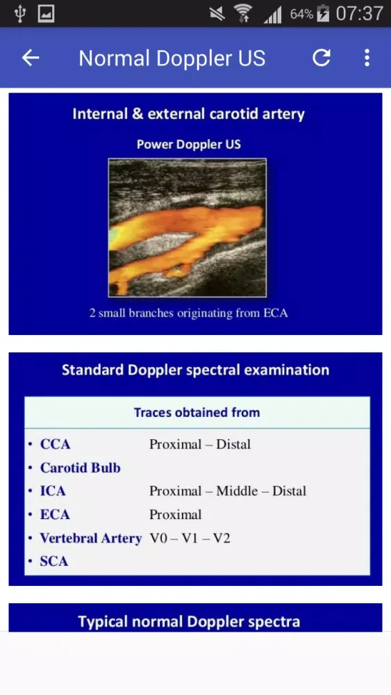 ภาพหน้าจอของ Doppler US Of Carotid arteries