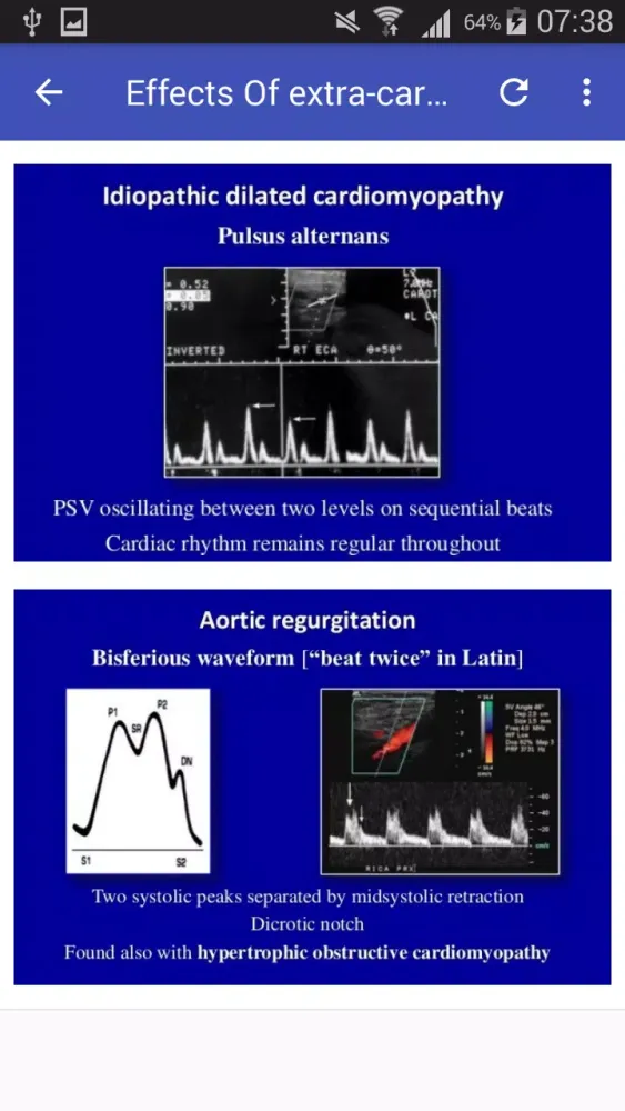ภาพหน้าจอของ Doppler US Of Carotid arteries