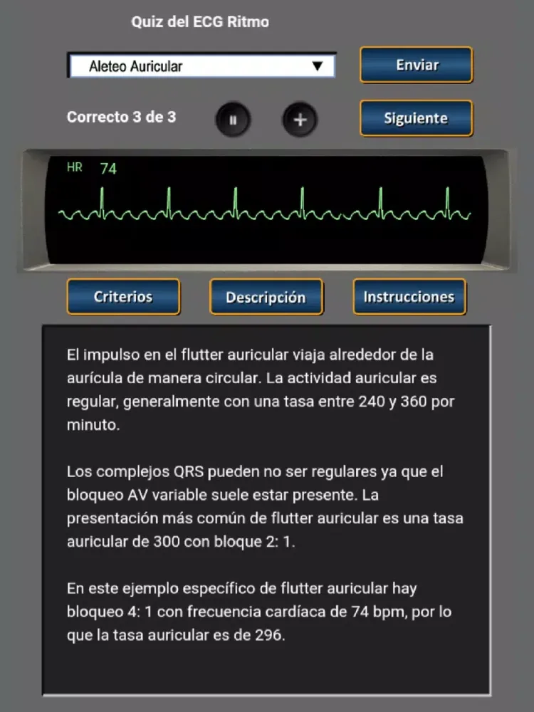 Quiz del ECG Ritmo iPad  Screenshots
