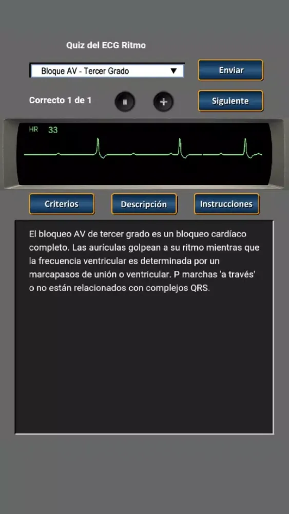 Quiz del ECG Ritmo Screenshots