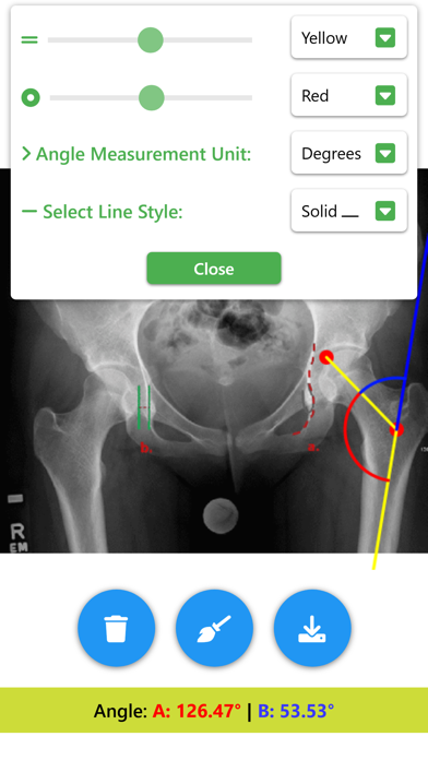 Angle Meter & Cobb Angle Meter Screenshots
