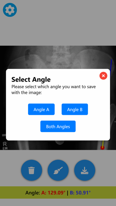 Angle Meter & Cobb Angle Meter Screenshots