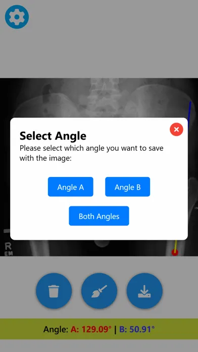Angle Meter & Cobb Angle Meter স্ক্রিনশট