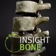 INSIGHT BONE INSIGHT BONE