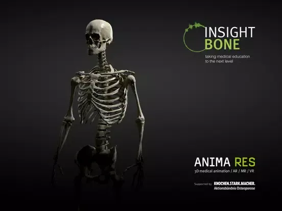 Captures d'écran de INSIGHT BONE iPad 