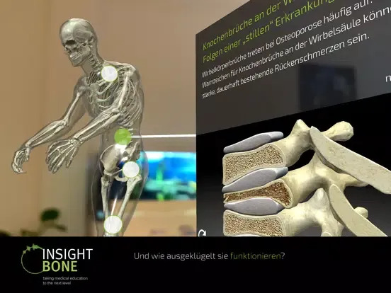 Captures d'écran de INSIGHT BONE iPad 