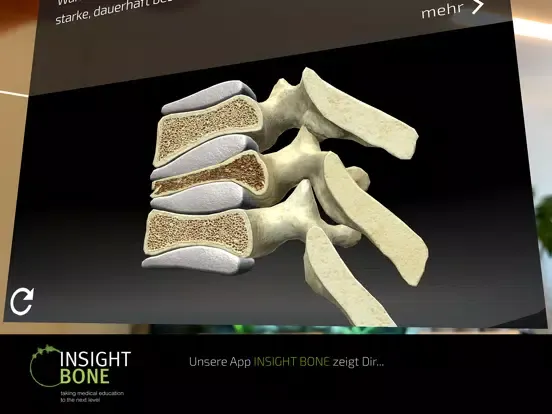 Captures d'écran de INSIGHT BONE iPad 