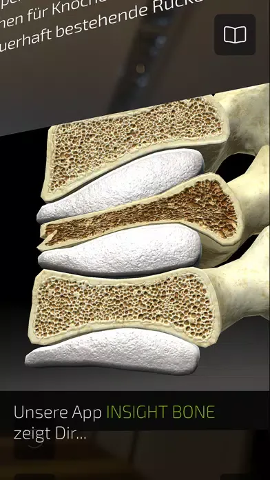 Captures d'écran de INSIGHT BONE