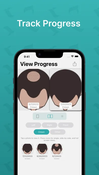 Captures d'écran de Hairly: Fight Hair Loss