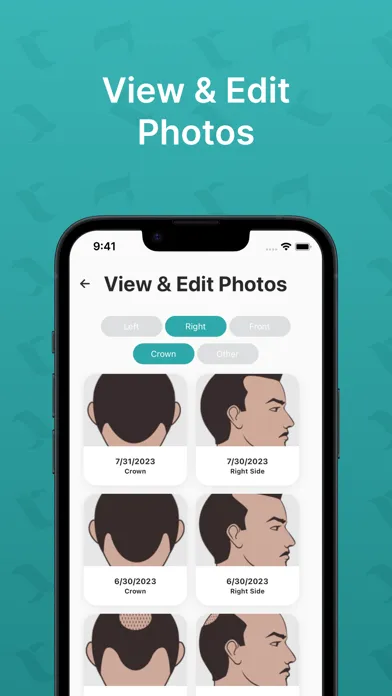 Captures d'écran de Hairly: Fight Hair Loss