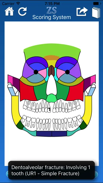 ZS Maxillofacial Trauma Score Screenshots