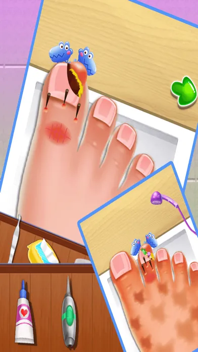 Nail doctor : Kids games toe surgery doctor games Screenshots