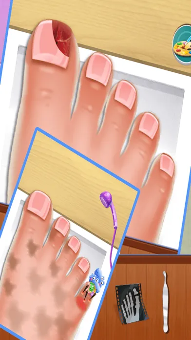 Nail doctor : Kids games toe surgery doctor games Screenshots
