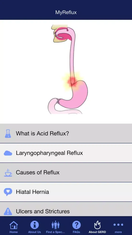 Tangkapan layar MyReflux