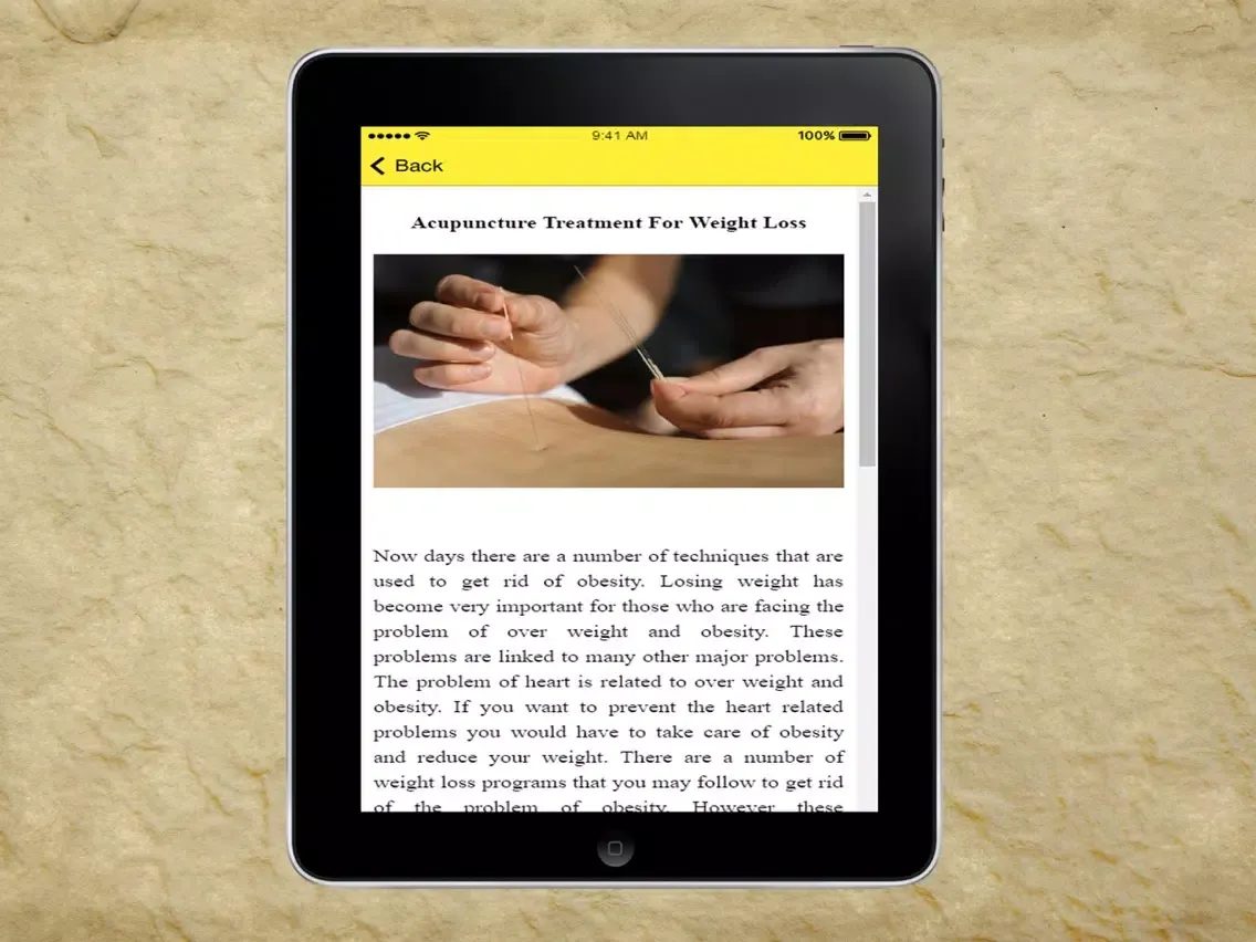 صور Chinese Acupuncture Therapy - Treatment For Weight Loss iPad 