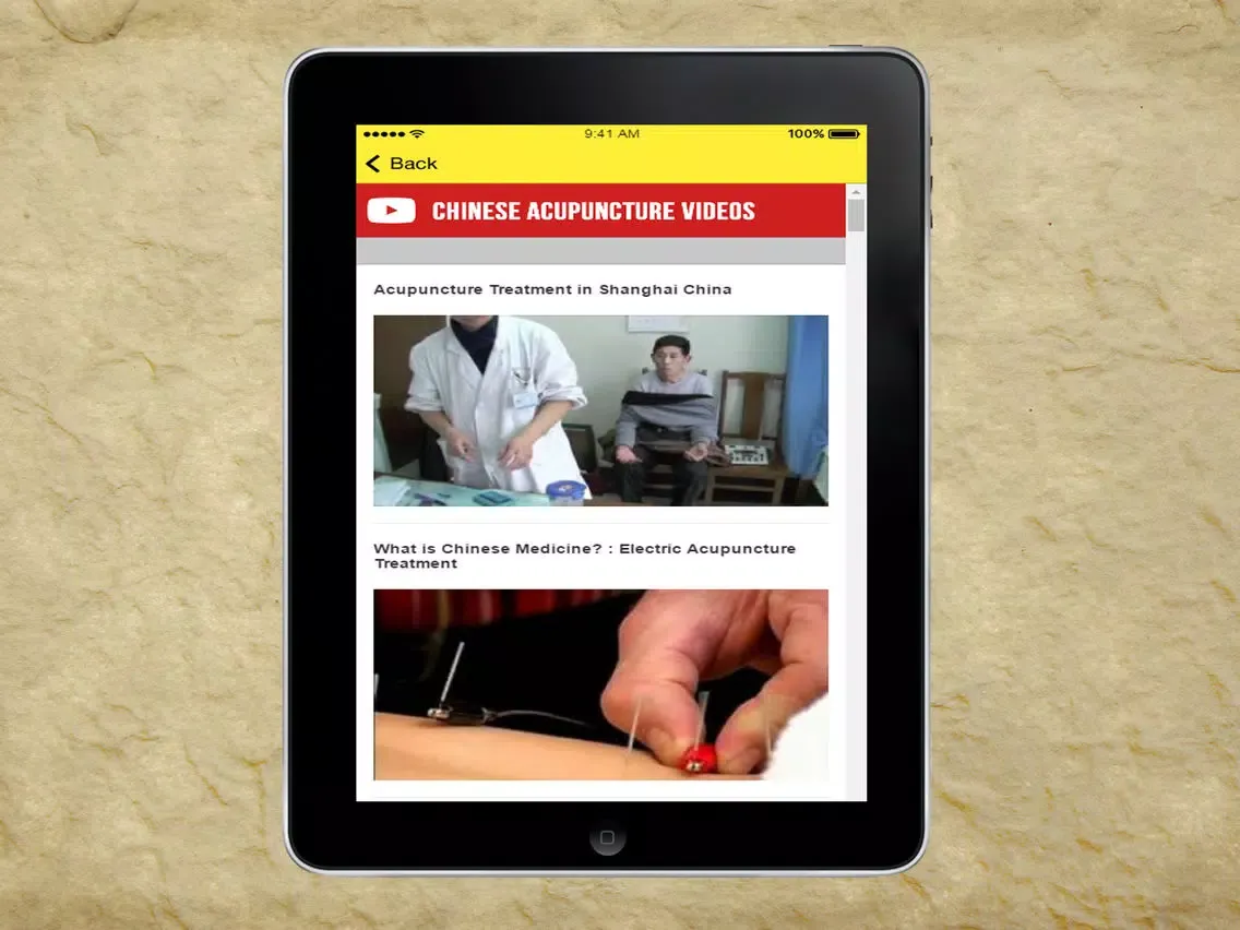 صور Chinese Acupuncture Therapy - Treatment For Weight Loss iPad 