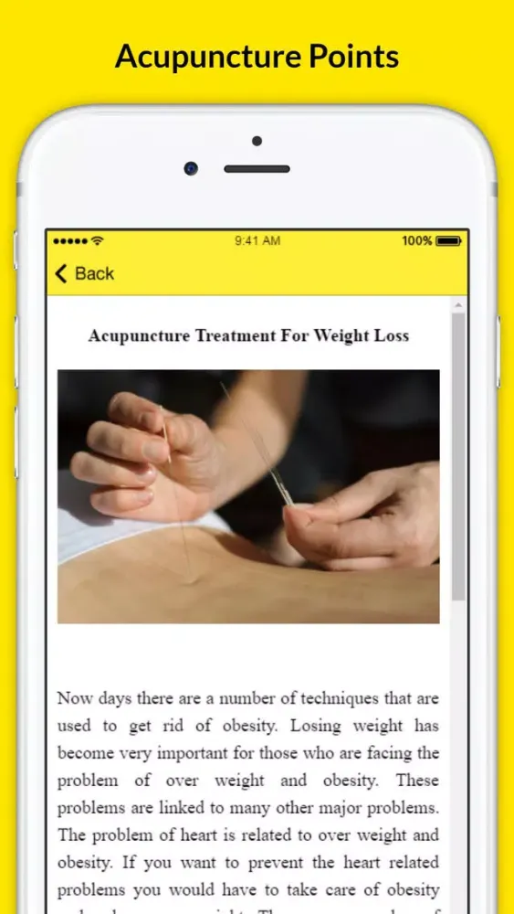 صور Chinese Acupuncture Therapy - Treatment For Weight Loss