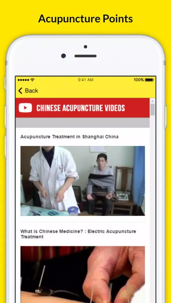 صور Chinese Acupuncture Therapy - Treatment For Weight Loss