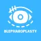 Blepharoplasty Cost & Info