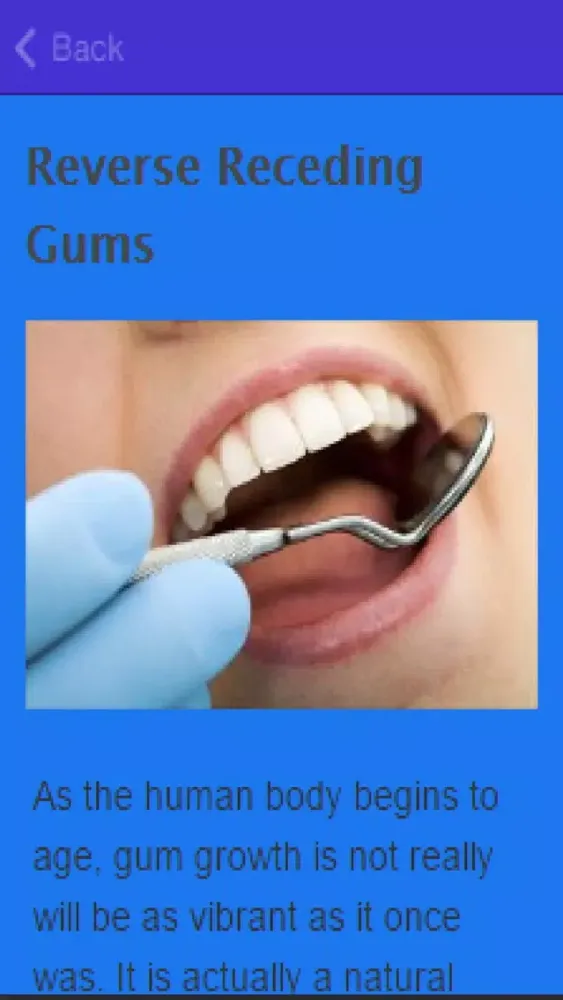 How To Stop Receding Gums Ekran Görüntüleri