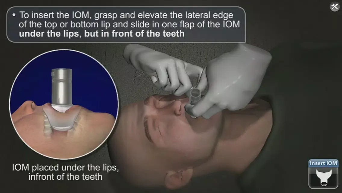 ภาพหน้าจอของ DeviceDrills: NuMask IOM® and OPA