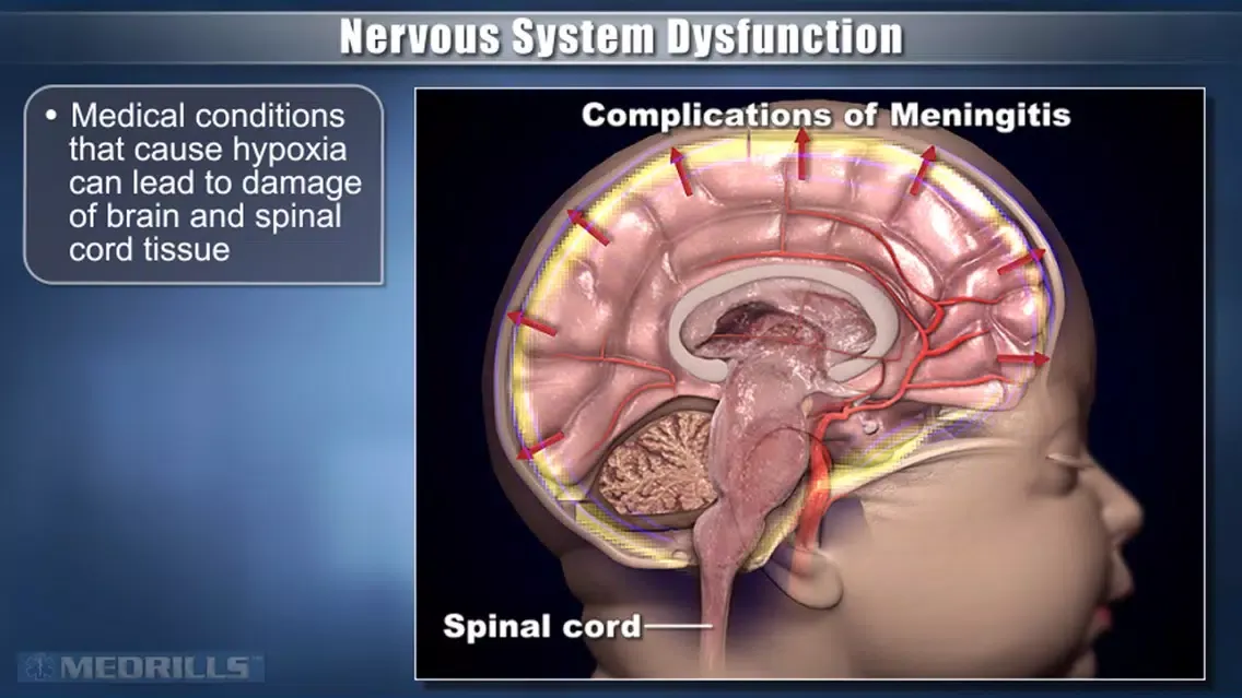 Captures d'écran de Medrills: Pathophysiology