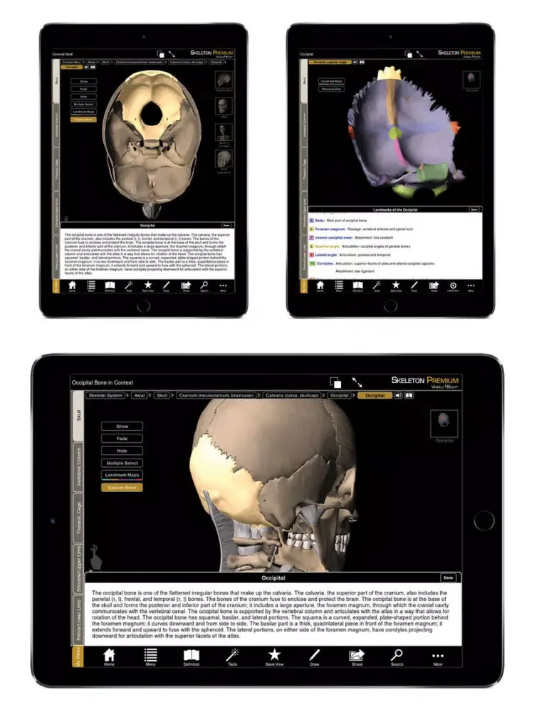Skeleton Premium iPad  Screenshots