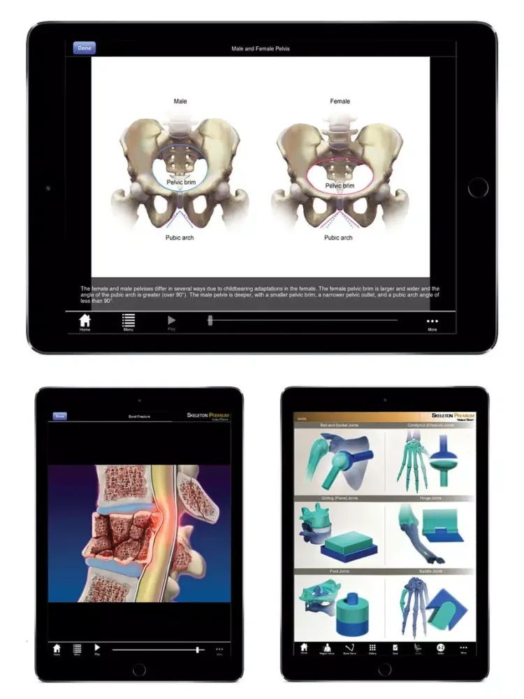 Skeleton Premium iPad  Screenshots