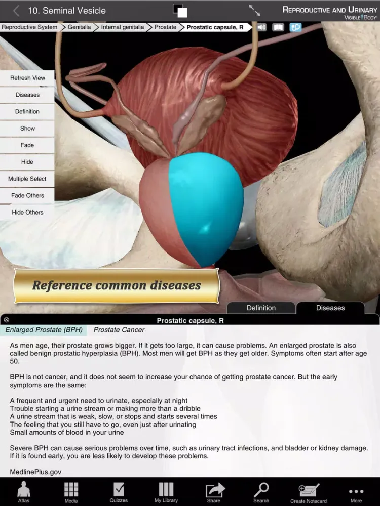 Ảnh chụp màn hình của Reproductive and Urinary Anatomy Atlas: Essential Reference for Students and Healthcare Professionals iPad 