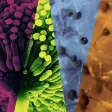 Management of Invasive Molds