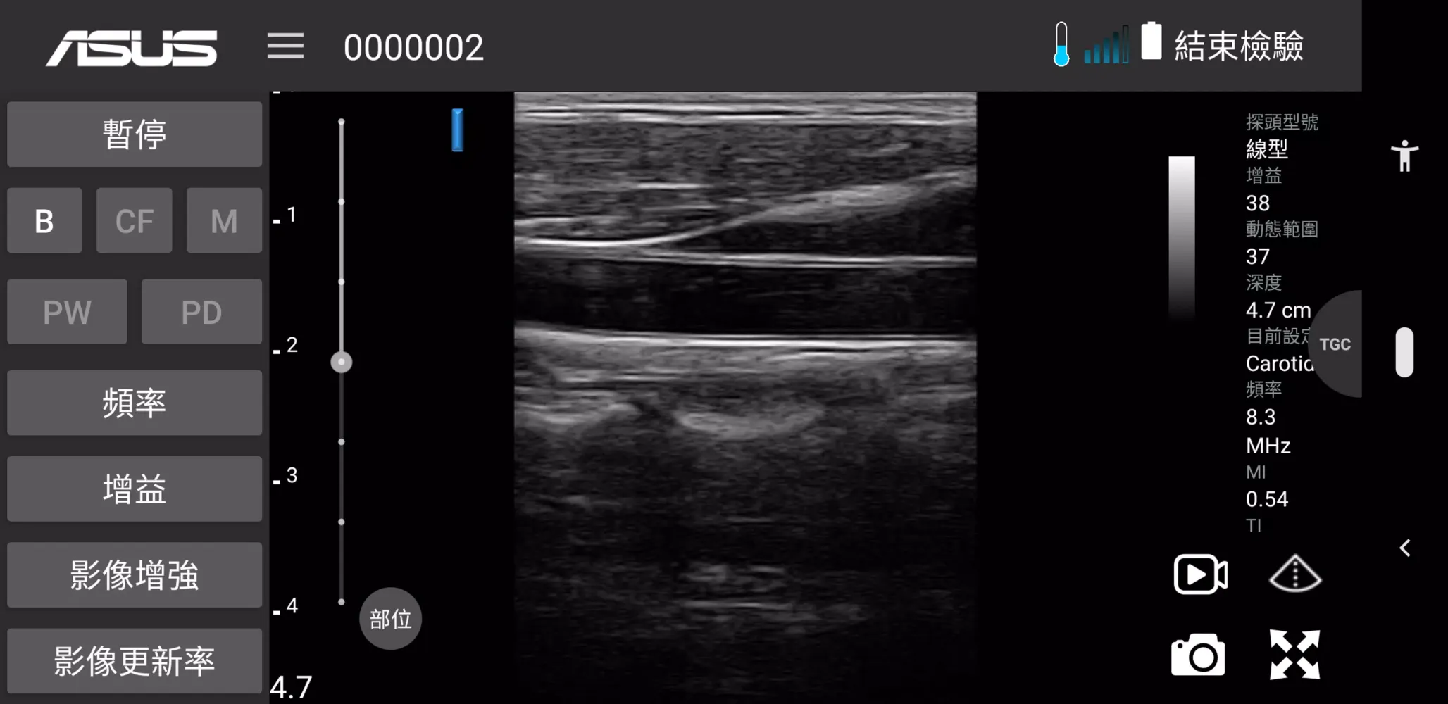 Скриншоты MediConnect – ASUS Ultrasound