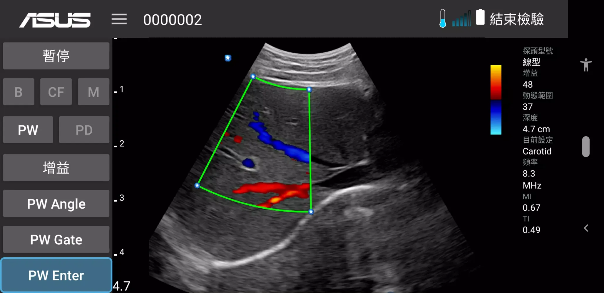 Скриншоты MediConnect – ASUS Ultrasound