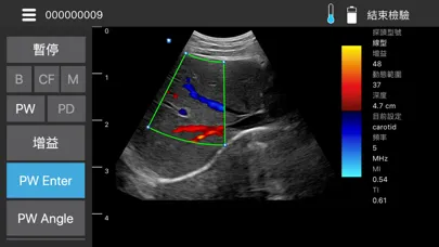 Скриншоты MediConnect - ASUS Ultrasound