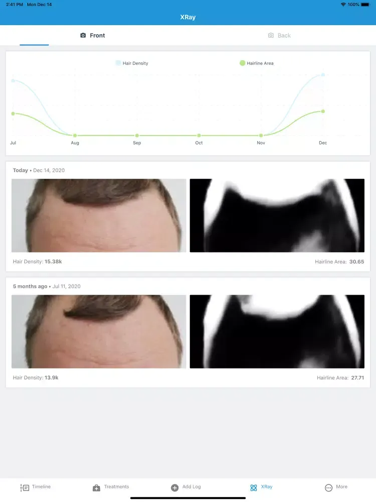 HairLog: Hair Regrowth Tracker iPad  Screenshots
