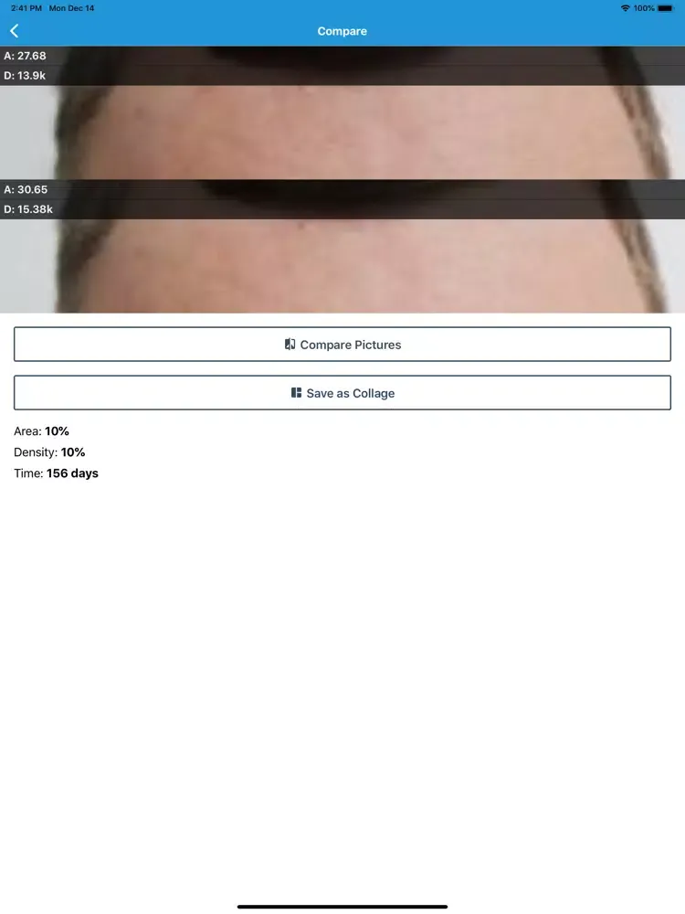 HairLog: Hair Regrowth Tracker iPad  Screenshots