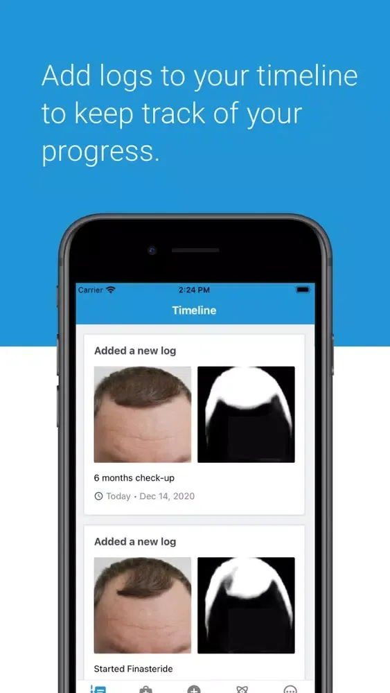 HairLog: Hair Regrowth Tracker Screenshots