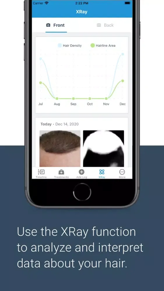 HairLog: Hair Regrowth Tracker Screenshots