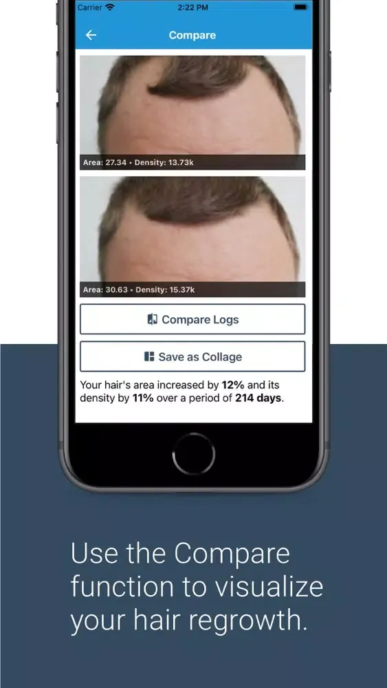 HairLog: Hair Regrowth Tracker Screenshots