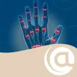 Juvenile Idiopathic Arthritis