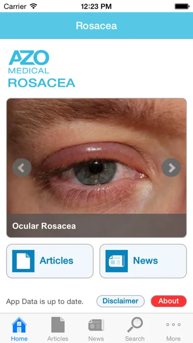 Rosacea by AZoMedical应用截图