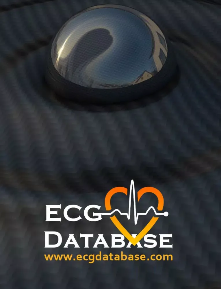 Capturas de pantalla de ECG Database iPad 