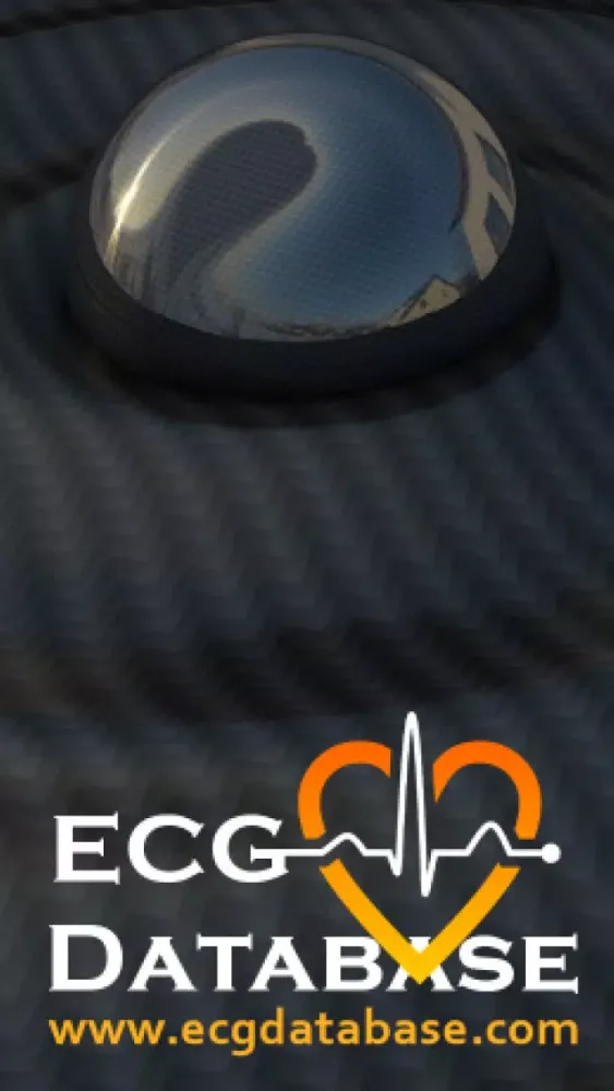 Capturas de pantalla de ECG Database