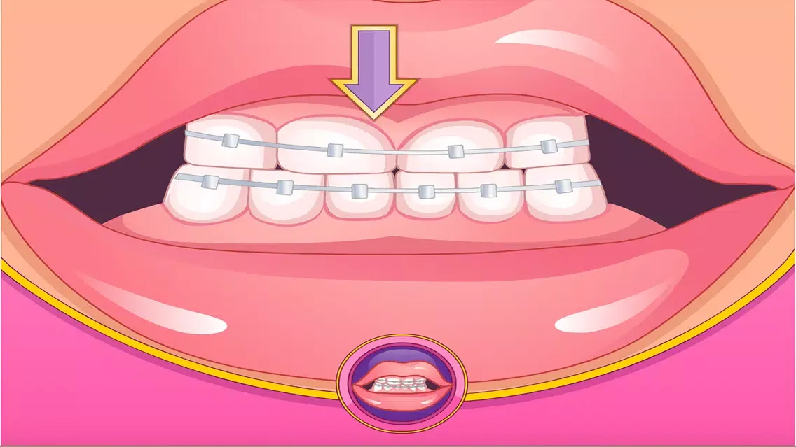 Capturas de tela do Bad Teeth Makeover Dentist